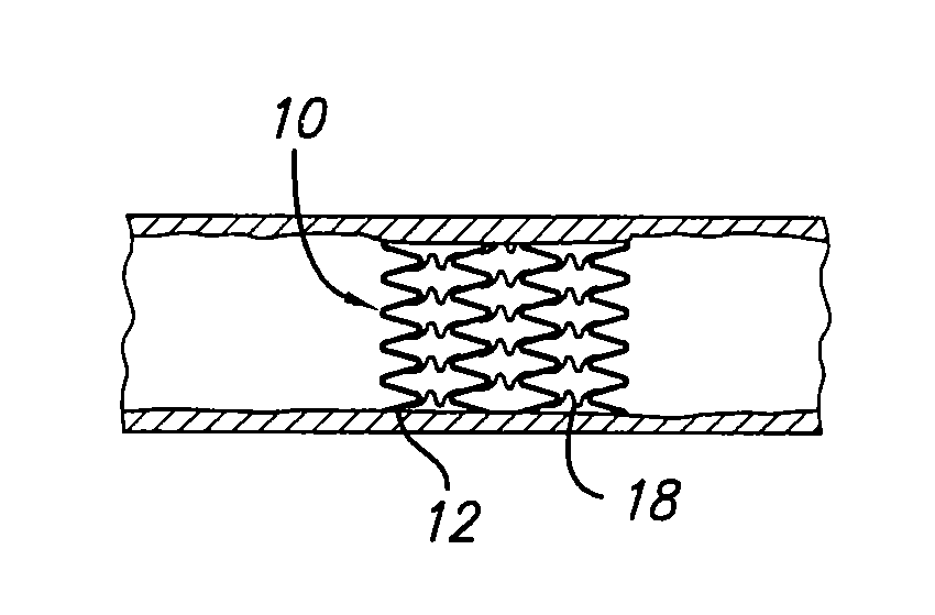 Flexible stent