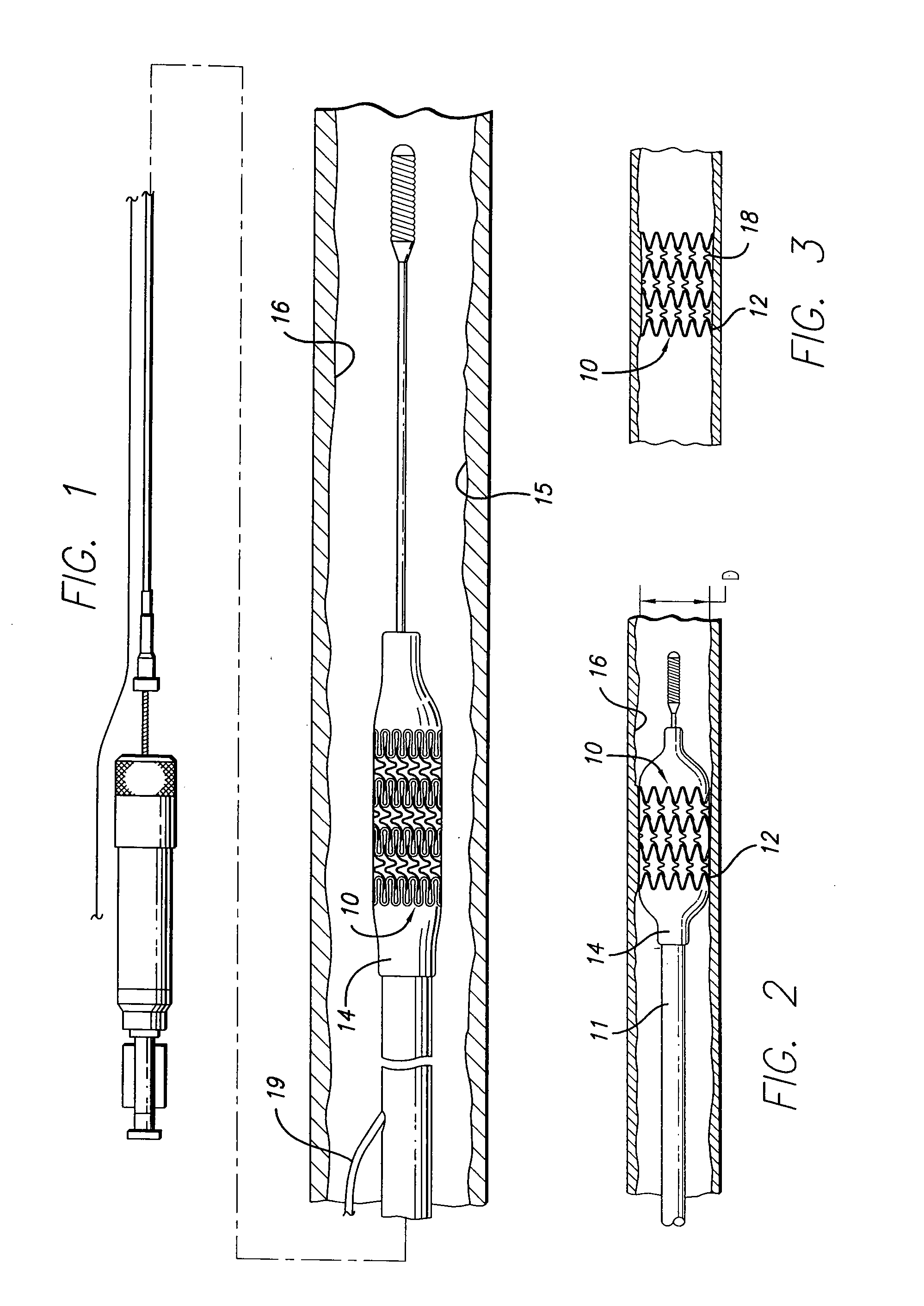 Flexible stent