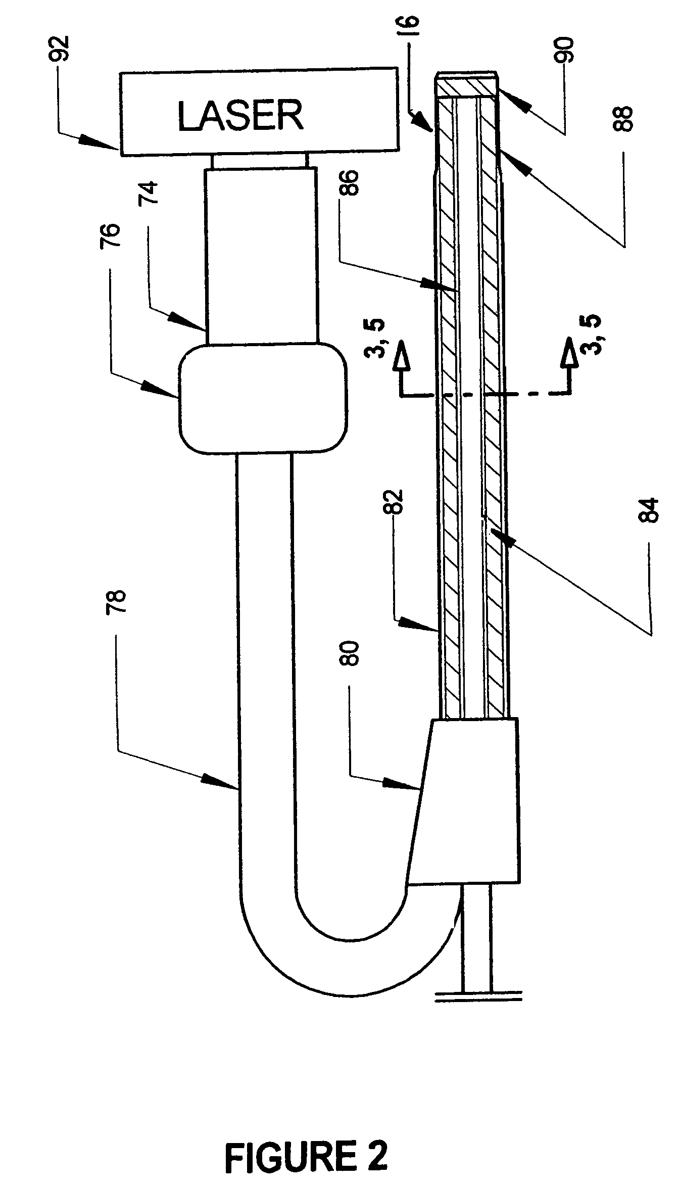 Excimer laser catheter