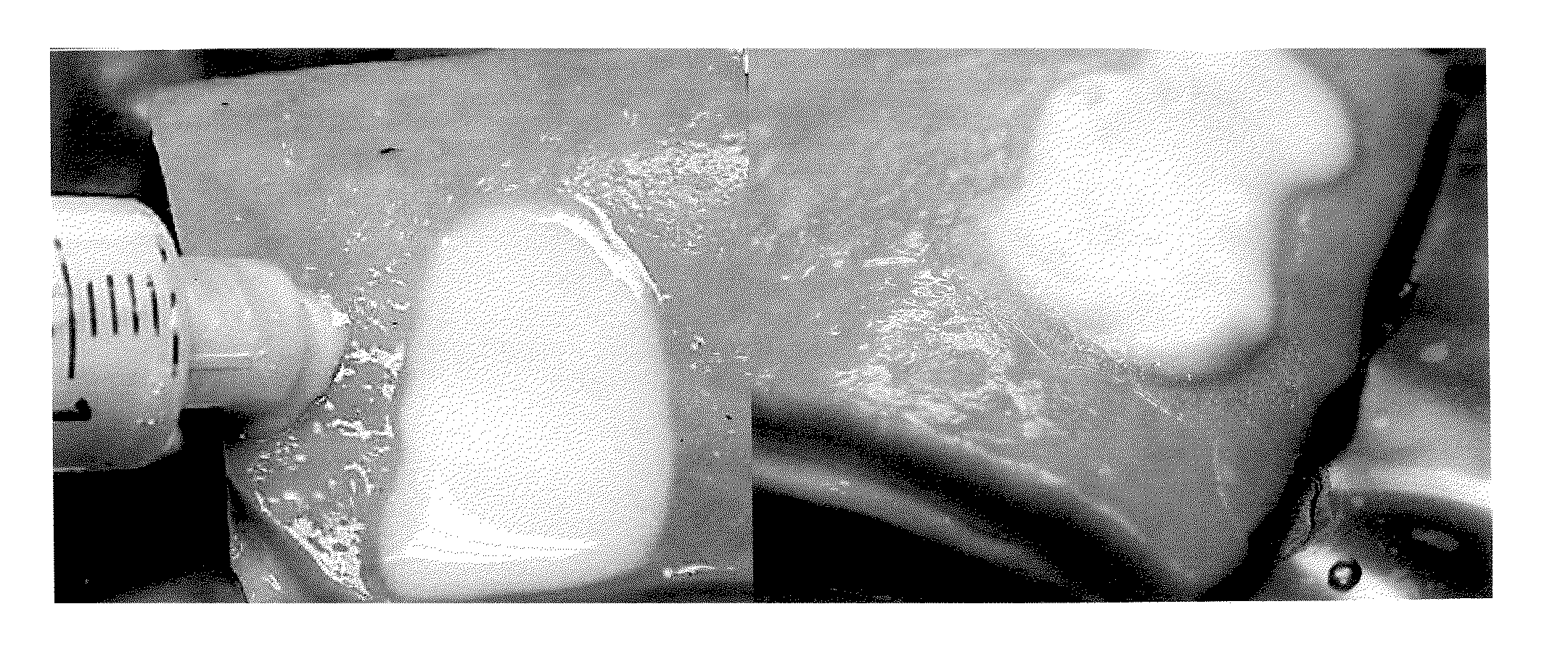 Adhesive medical products and methods for treating gastrointestinal lesions