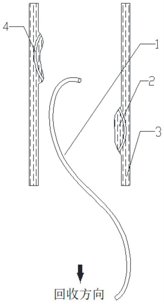 A retrievable vena cava filter