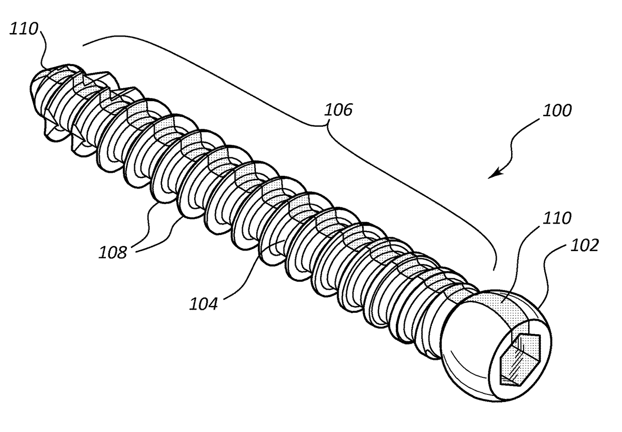 Pedicle screw with electro-conductive coating or portion