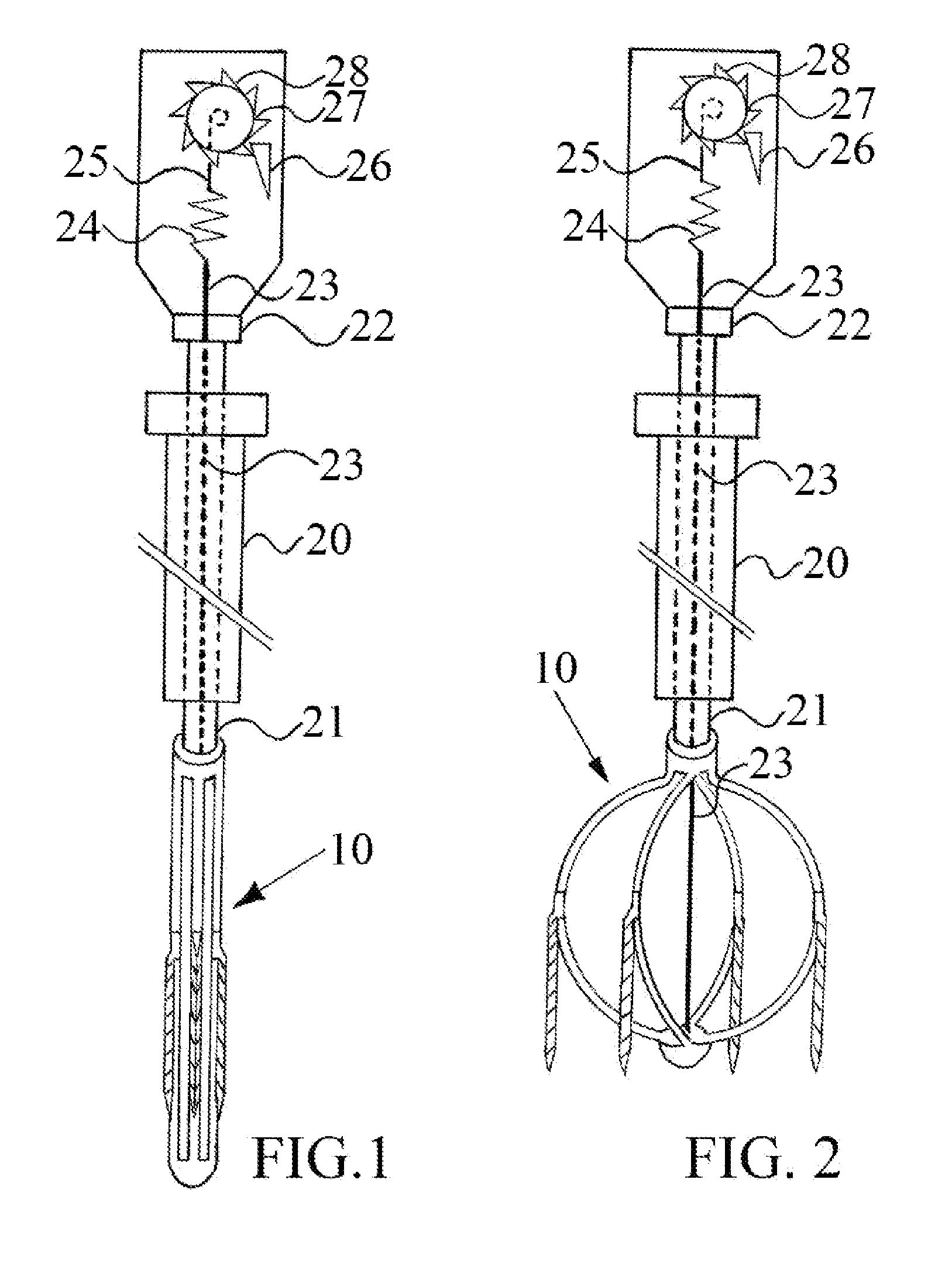 System for restoring cardiac muscular asynchronized contraction manner in a failing heart