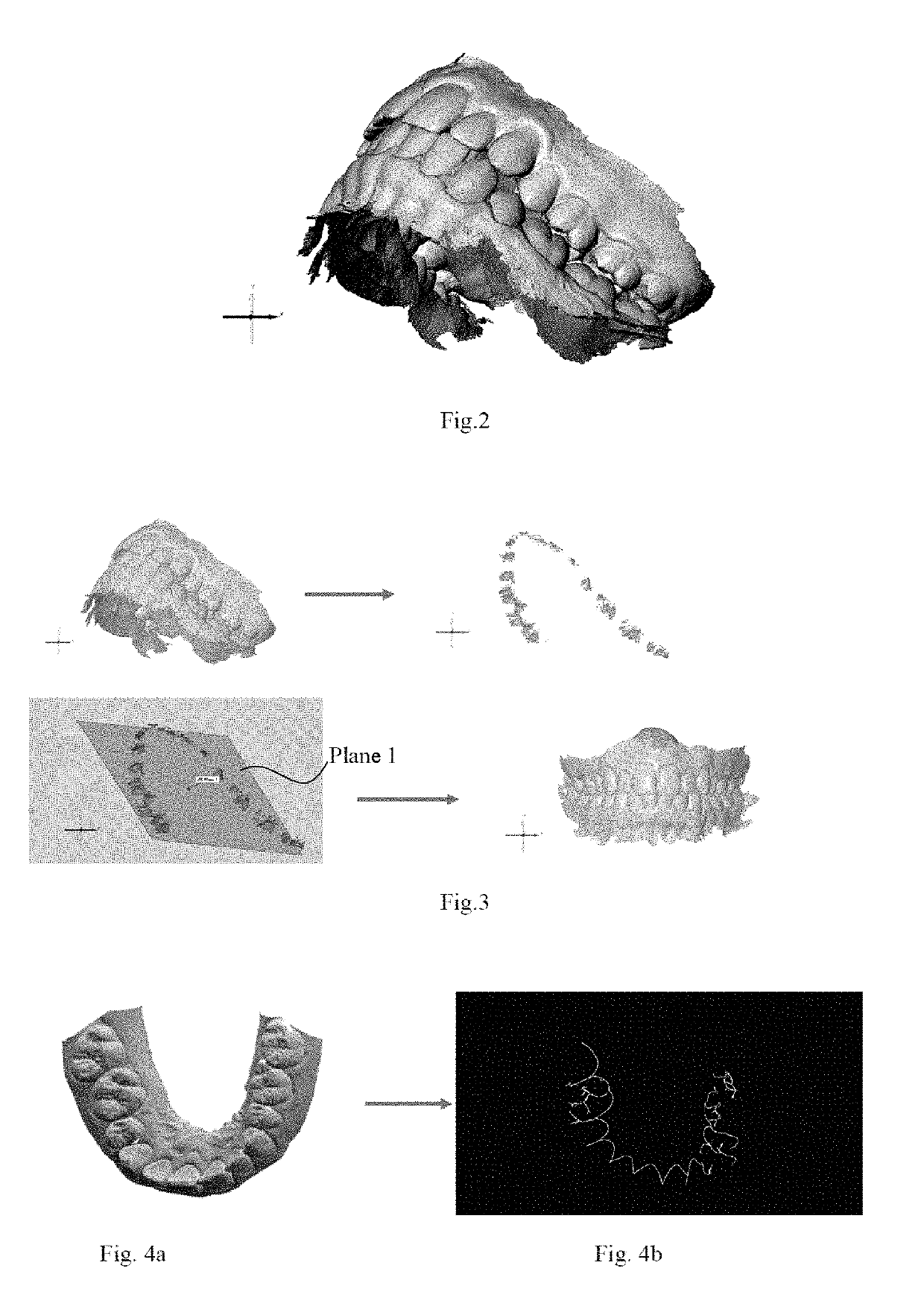 Dentition control method