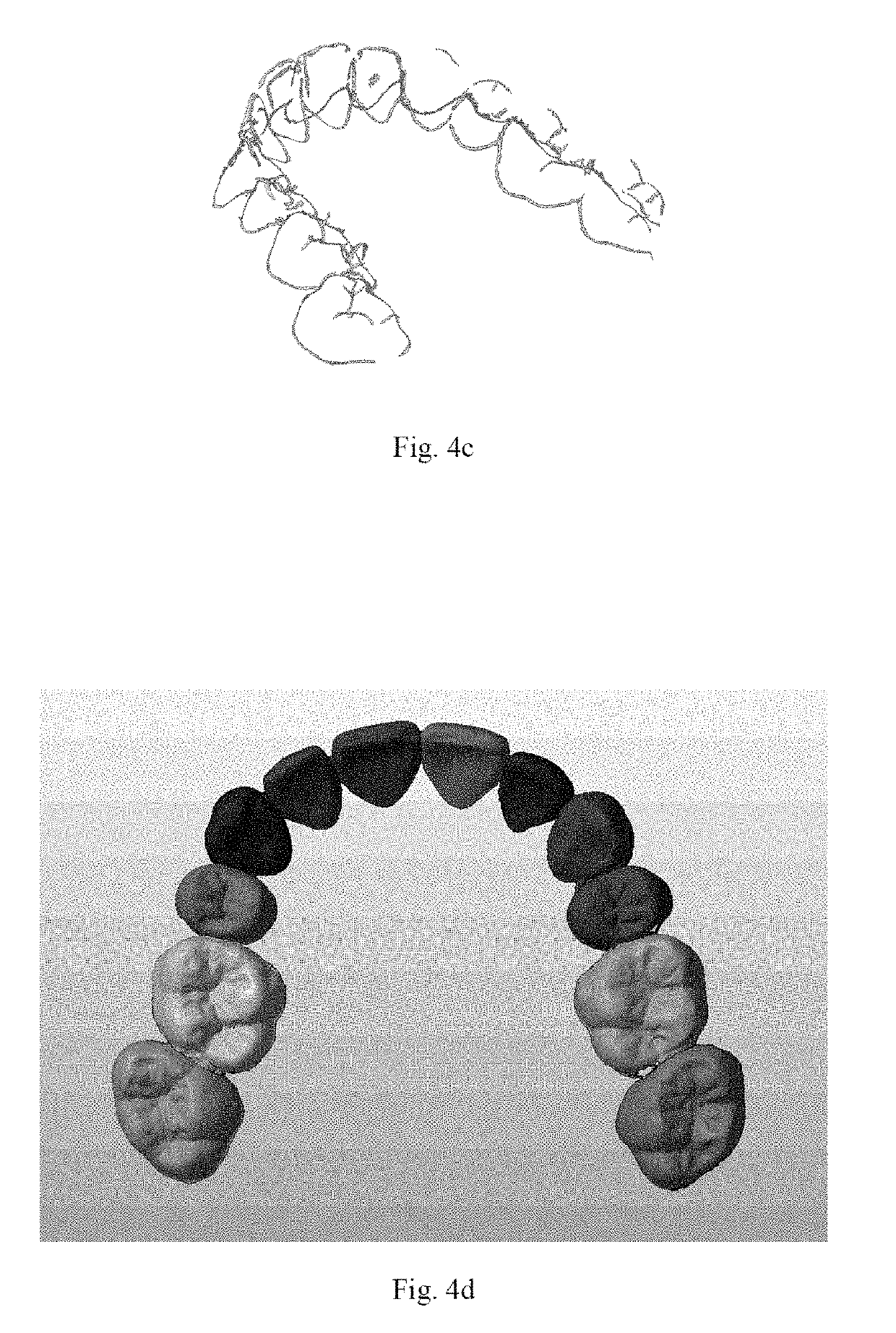 Dentition control method