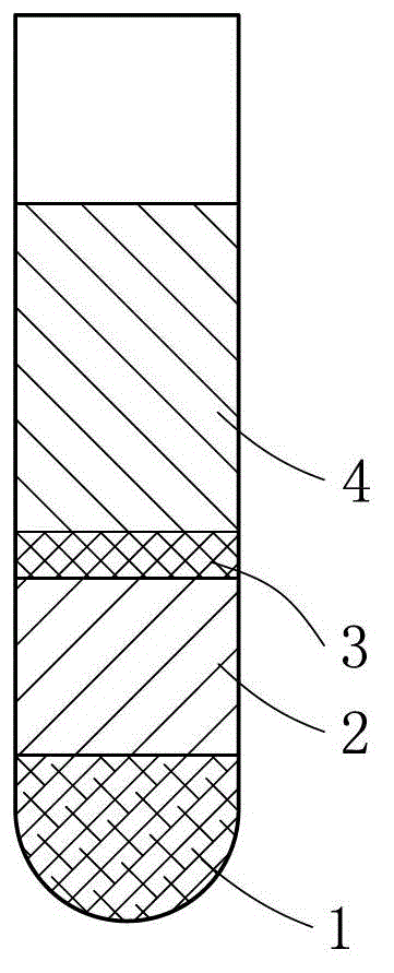 Platelet-rich plasma and bone powder collecting and separating device in operation