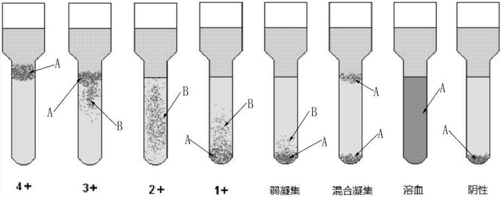 Microtube column agglutinatior agglutination assay result identification system and blood grouping analyzer