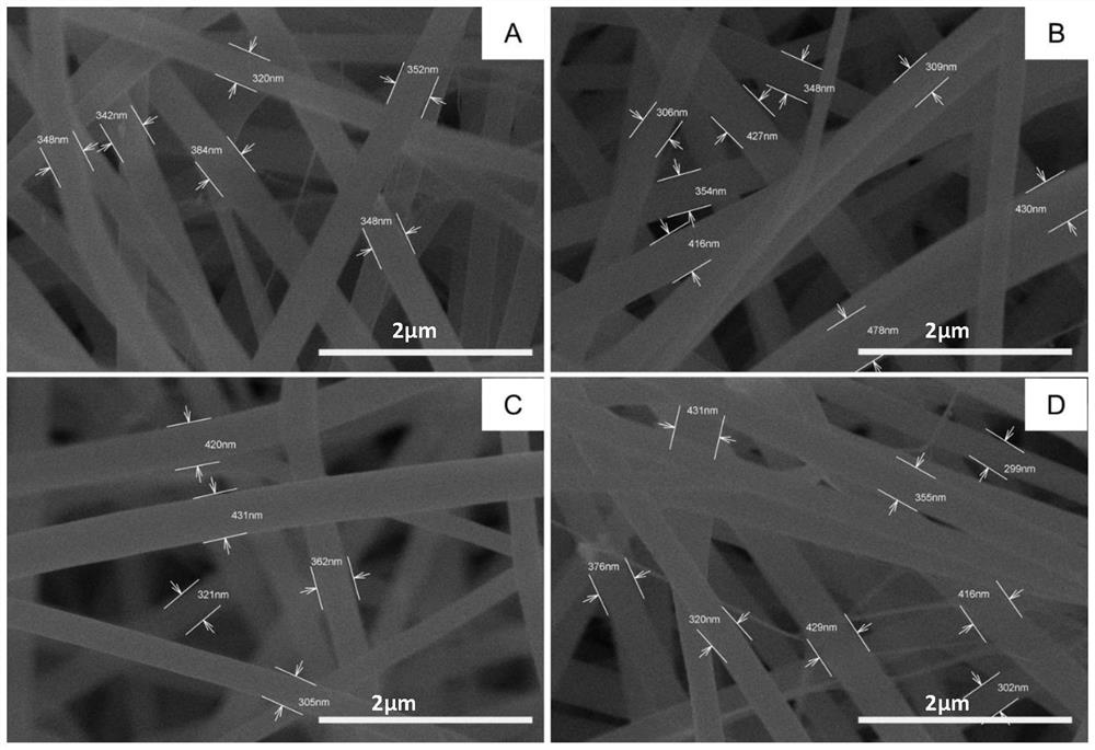 Preparation method of electrostatic spinning membrane for tissue defect repair