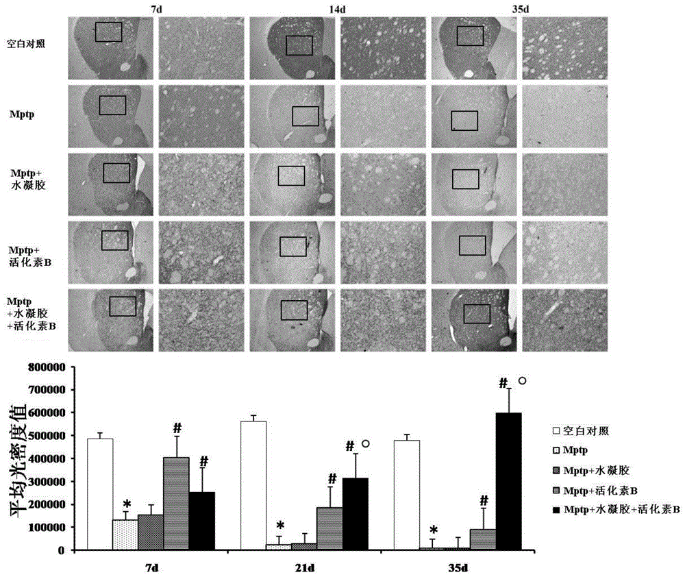 Biological agent with neuroprotective effect