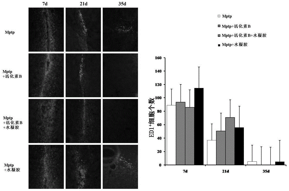 Biological agent with neuroprotective effect