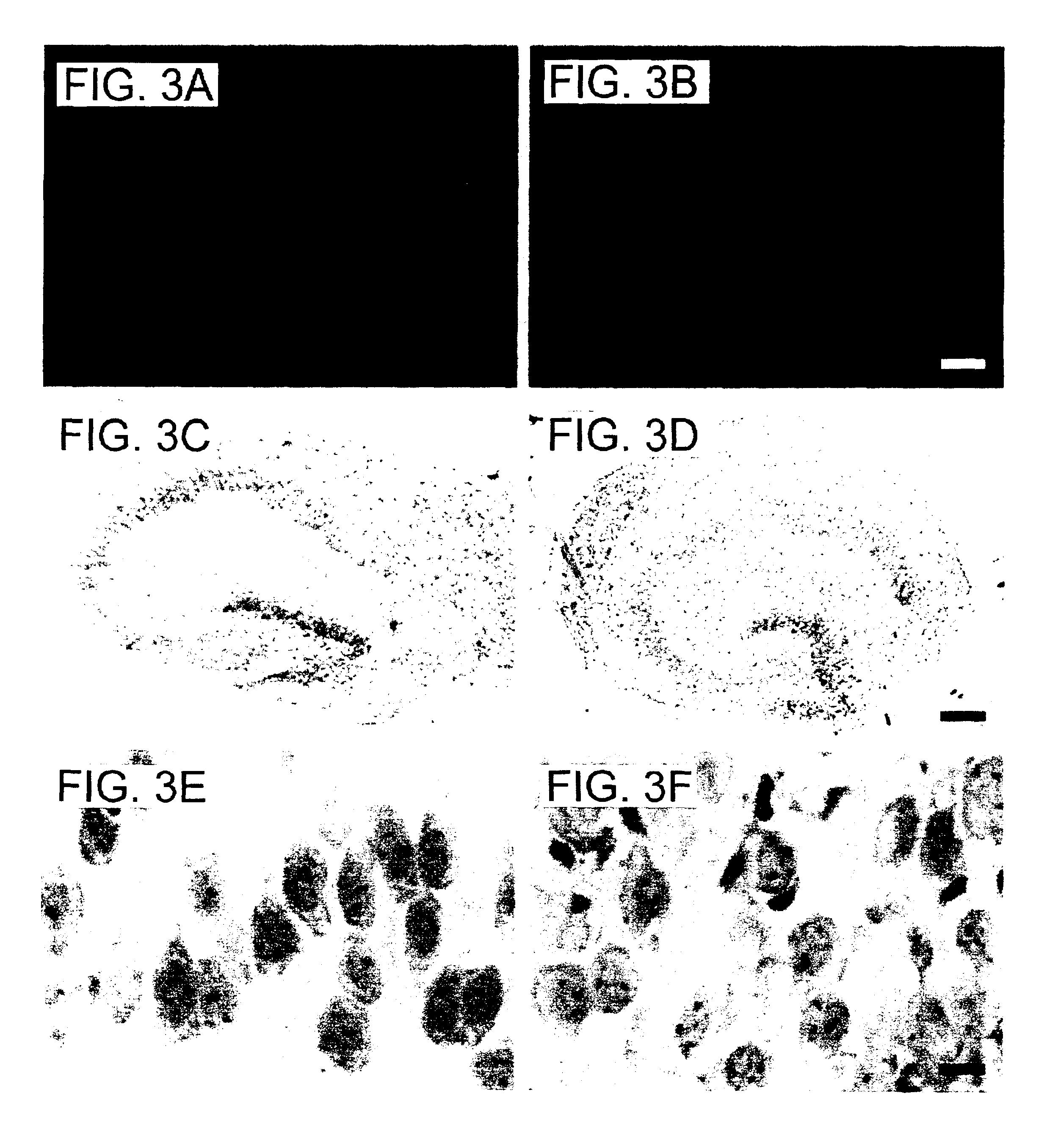 In vitro ischemia model