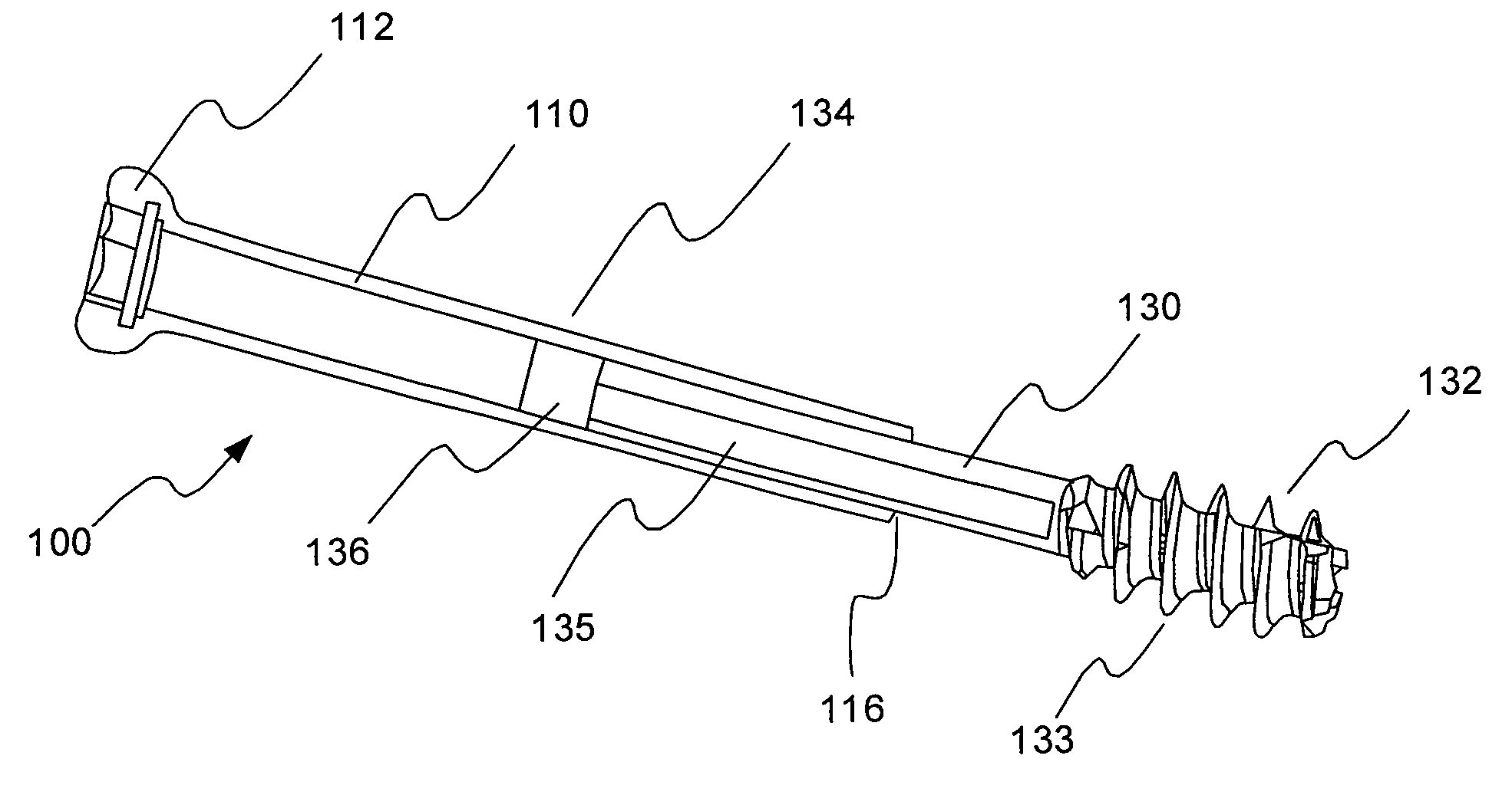 Bone screw system and method for the fixation of bone fractures