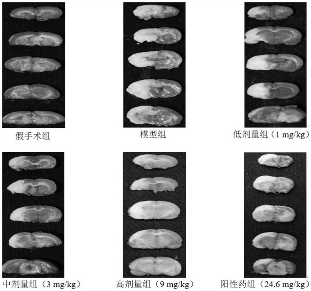 Use of a phosphodiesterase 9a inhibitor for preventing and treating ischemic stroke