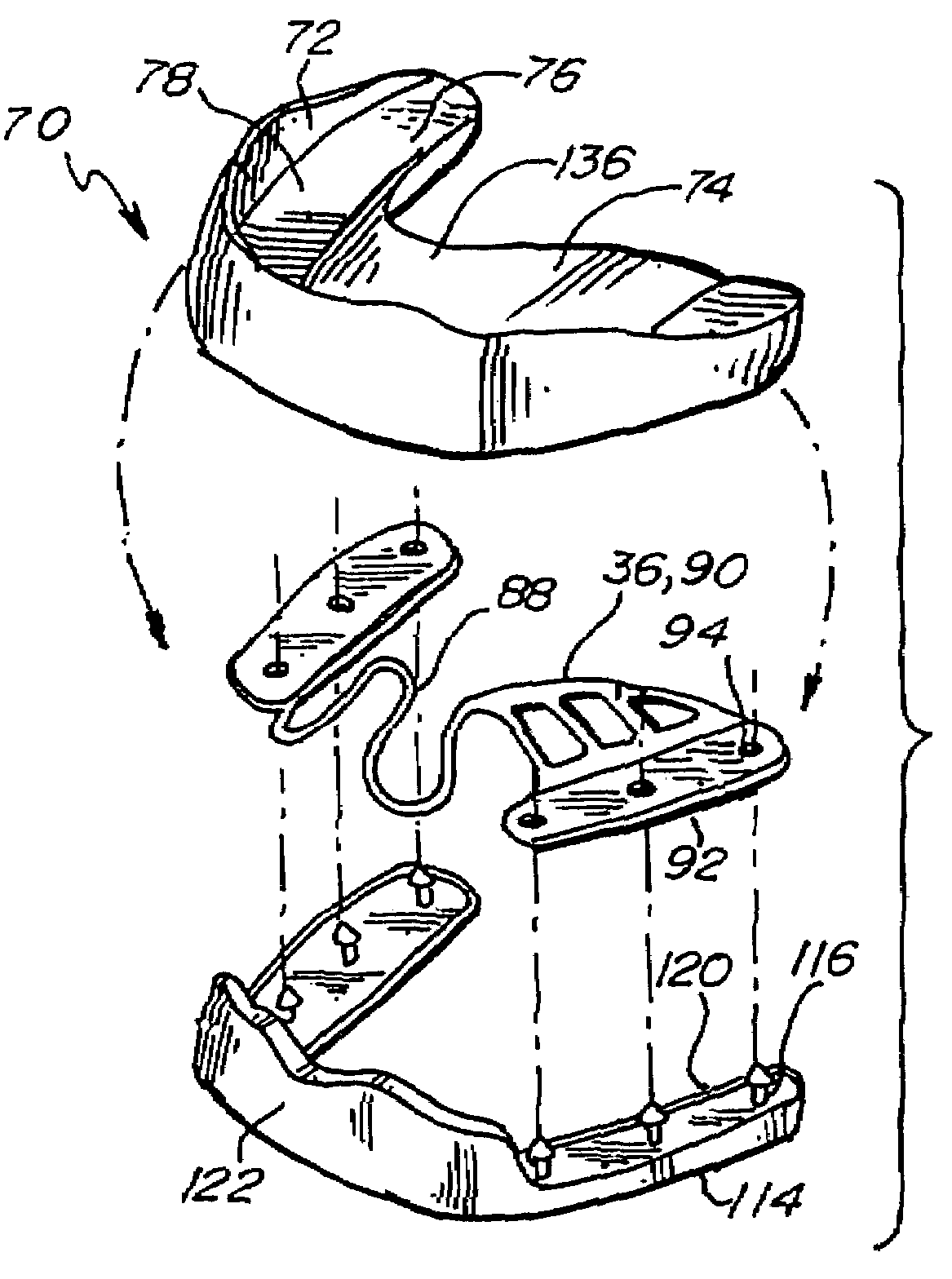 Three part composite performance enhancing mouthguard