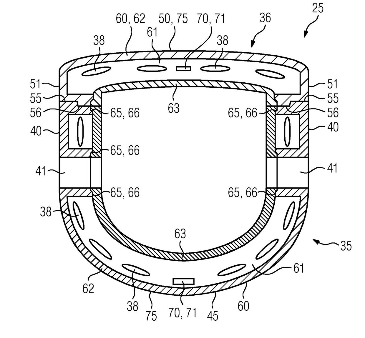 Local coil arrangement for use in an intervention supported by magnetic resonance imaging