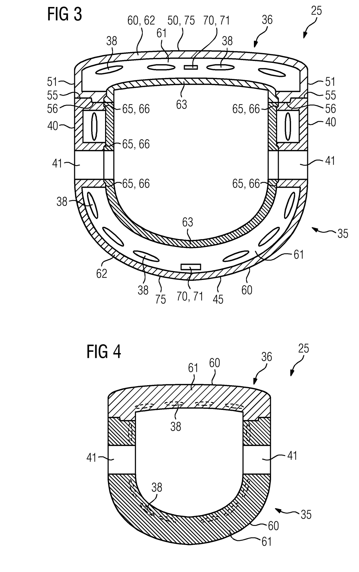 Local coil arrangement for use in an intervention supported by magnetic resonance imaging