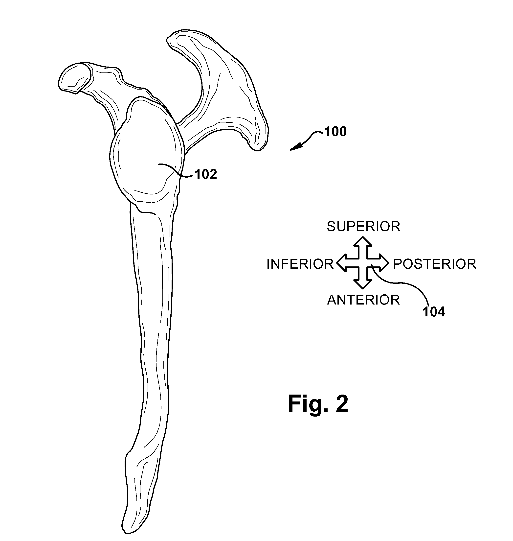 System and method for association of a guiding aid with a patient tissue