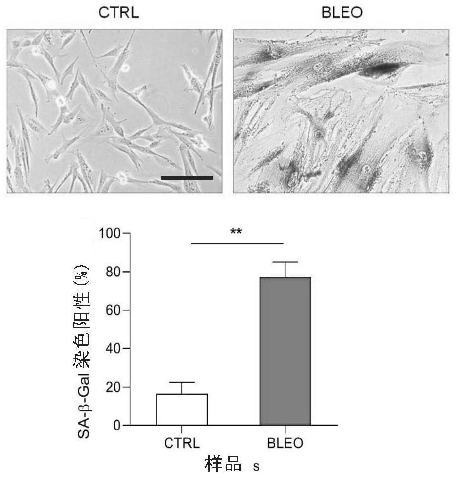 Application of cocoa extract in preparation of medicine for resisting aging and inhibiting tumors