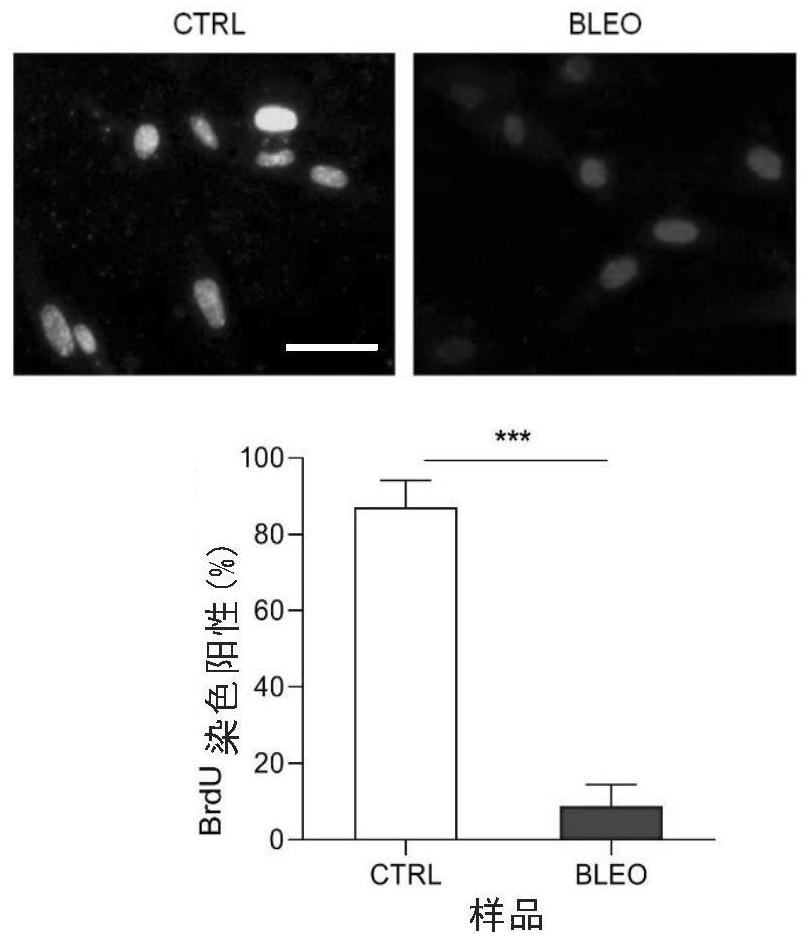 Application of cocoa extract in preparation of medicine for resisting aging and inhibiting tumors