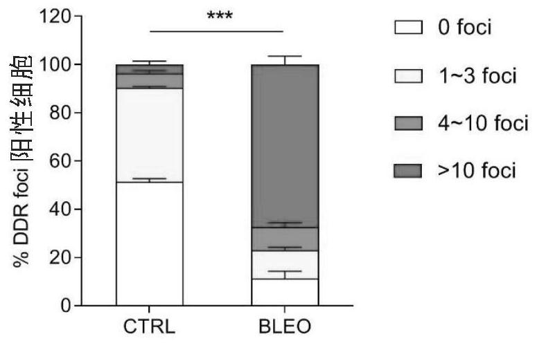 Application of cocoa extract in preparation of medicine for resisting aging and inhibiting tumors