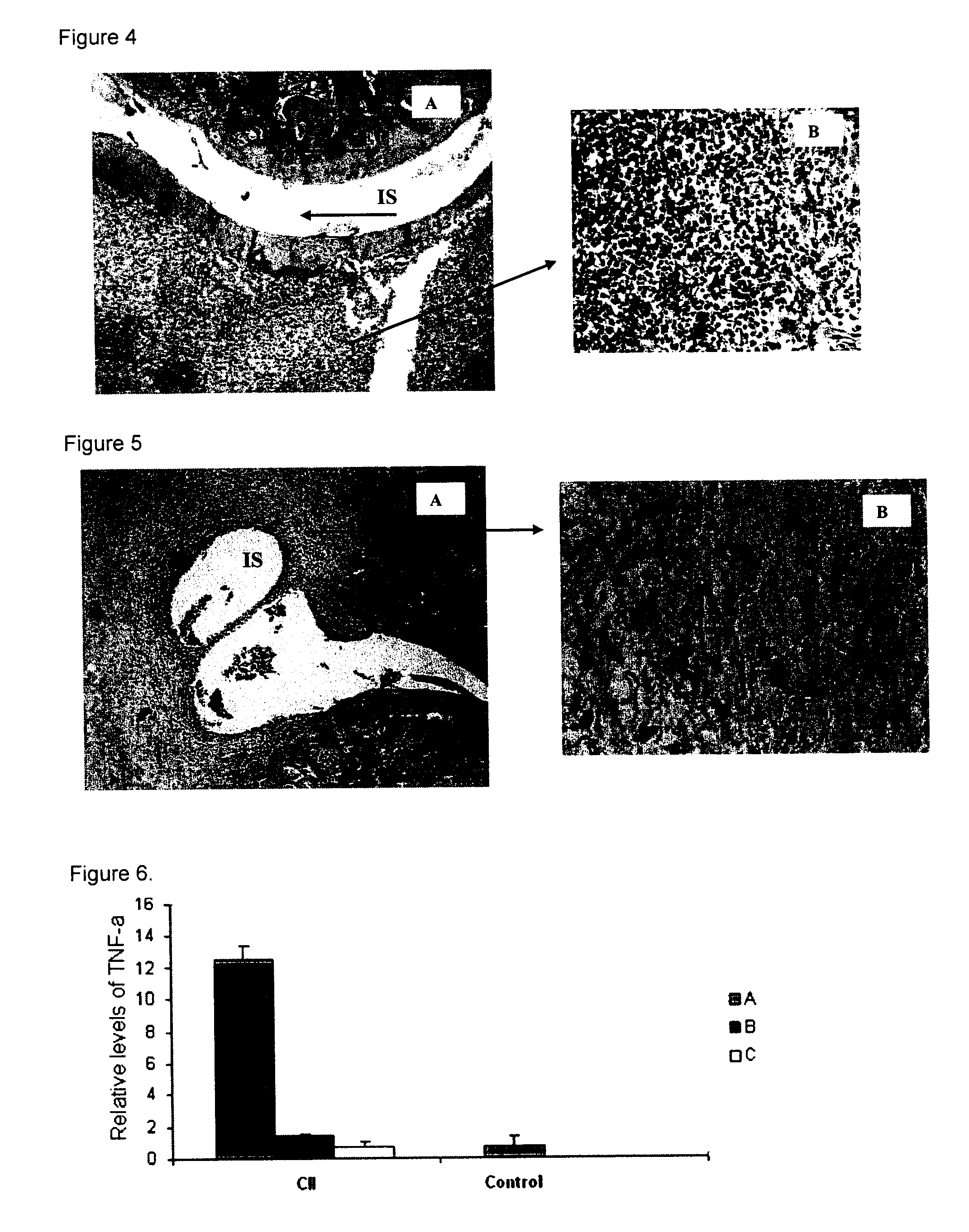 Peptides and apl-type derivatives of hsp60 and pharmaceutical compositions