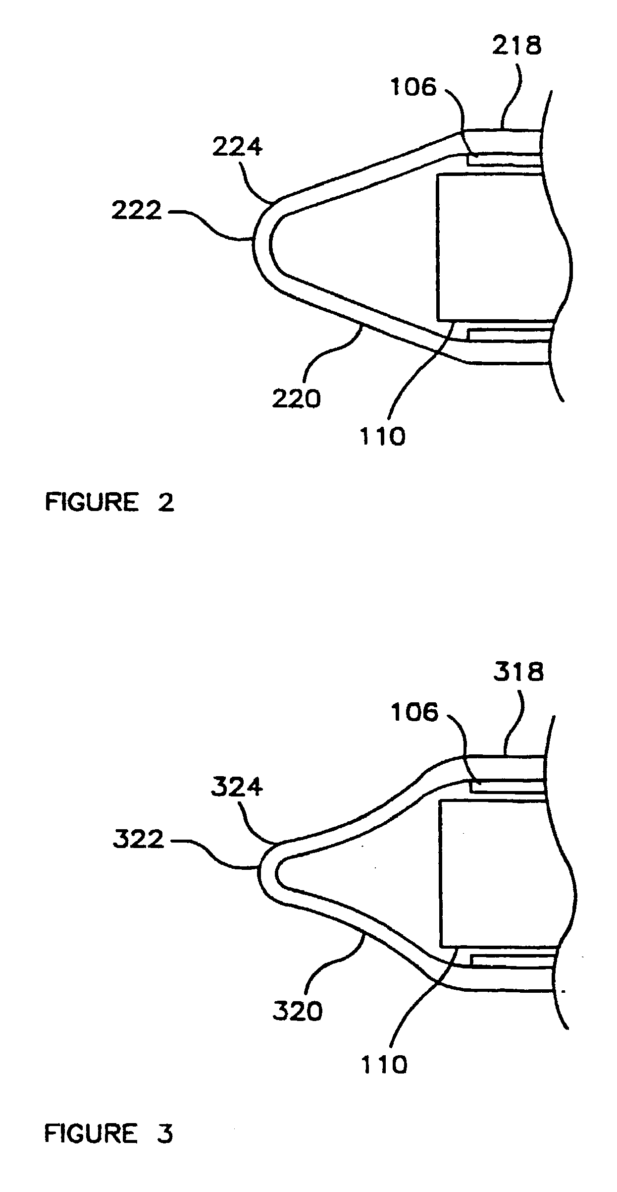 Tissue Dissection Method