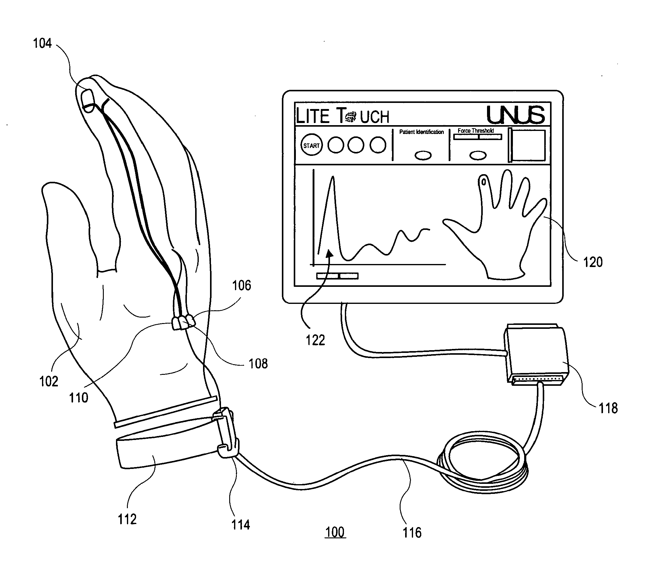 Clinical force sensing glove