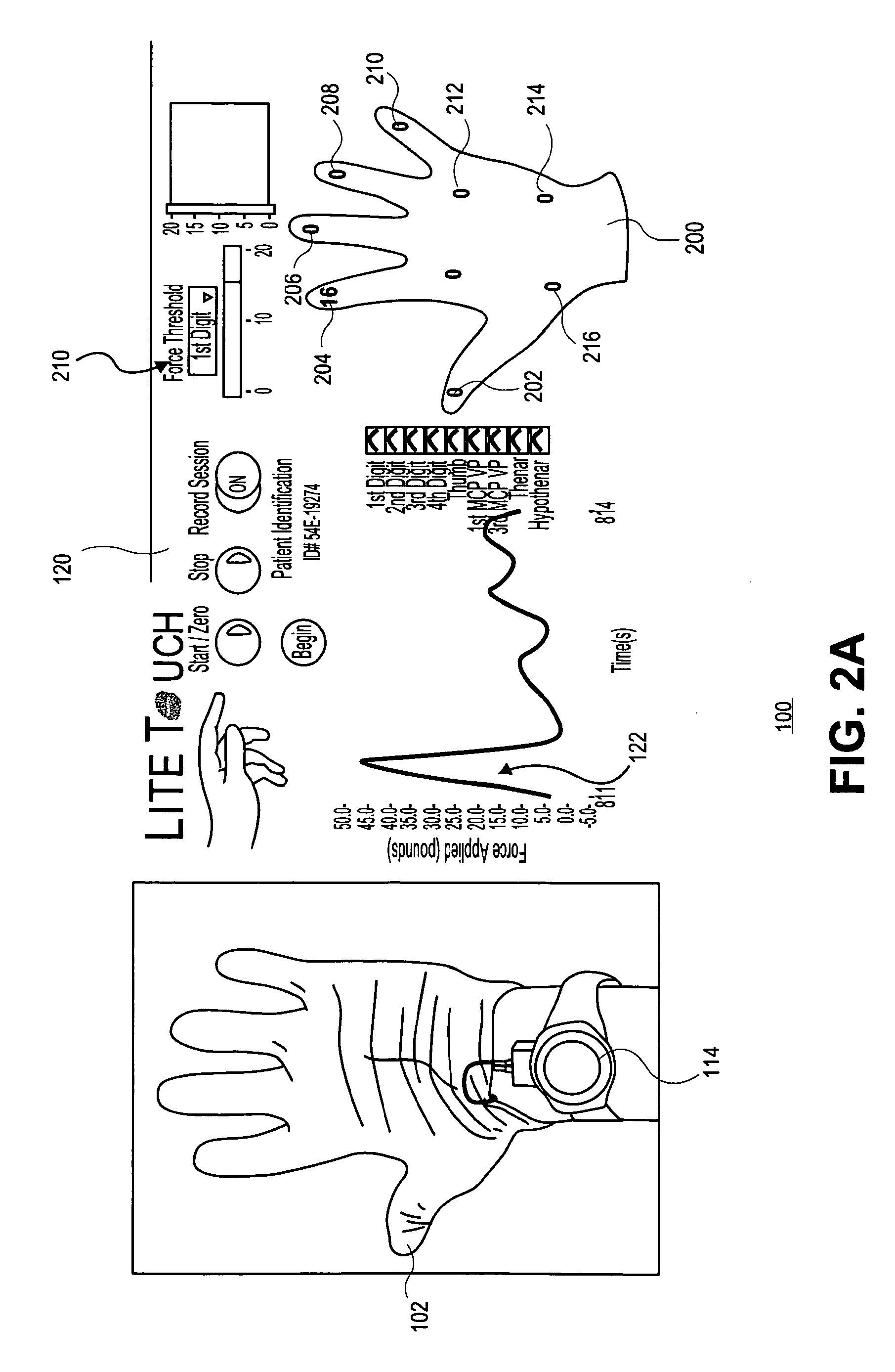 Clinical force sensing glove