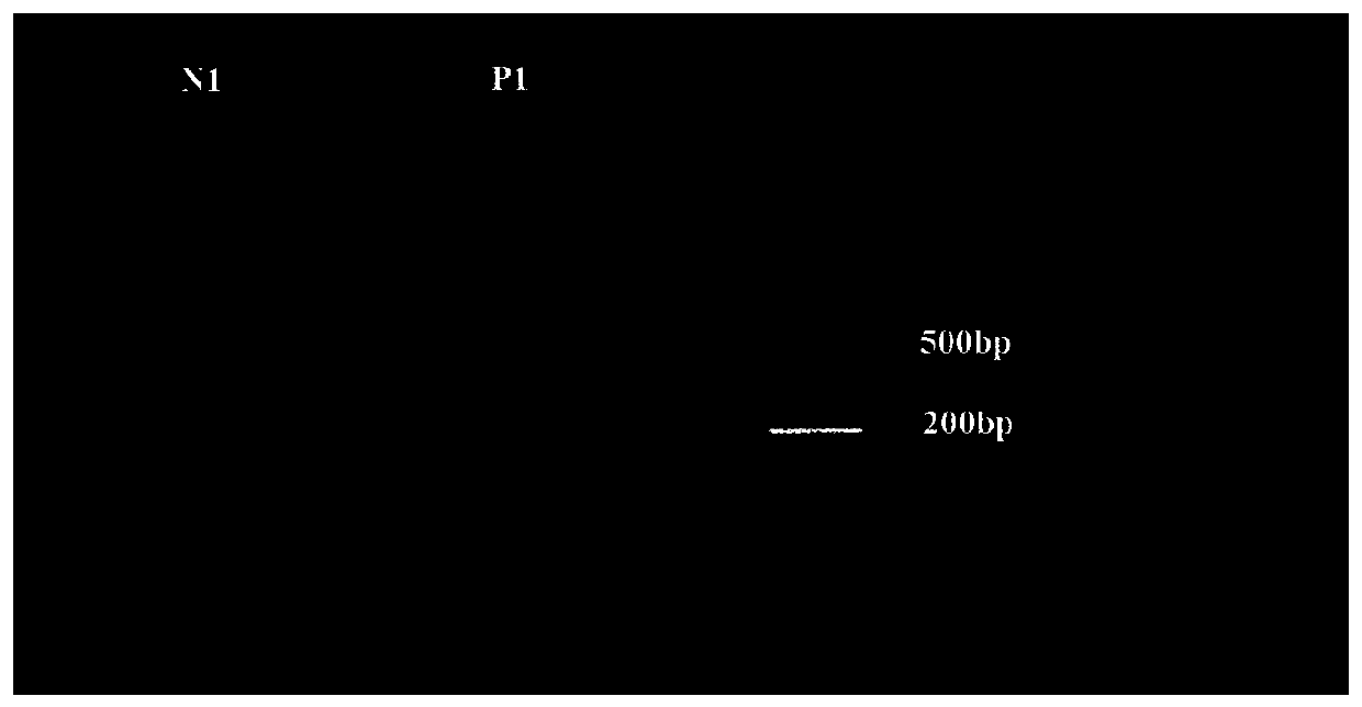 Biomarker of granulosa cells used for polycystic ovary syndrome (PCOS) diagnosis, and screening method and diagnostic kit thereof