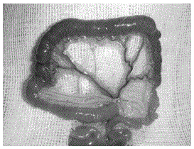 Establishment method for rat peripheral superior mesenteric vein thrombosis model