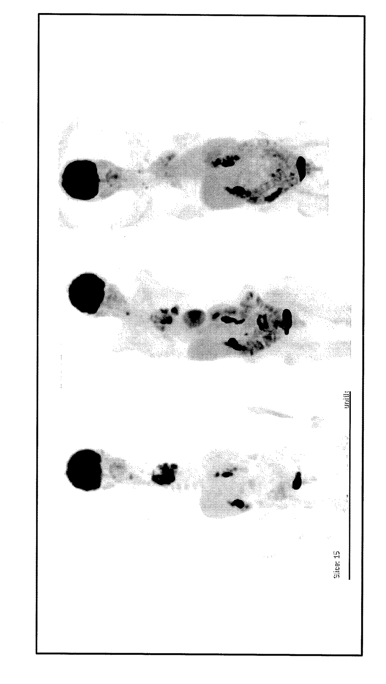 Multi-ingredient pharmaceutical composition for use in cancer therapy