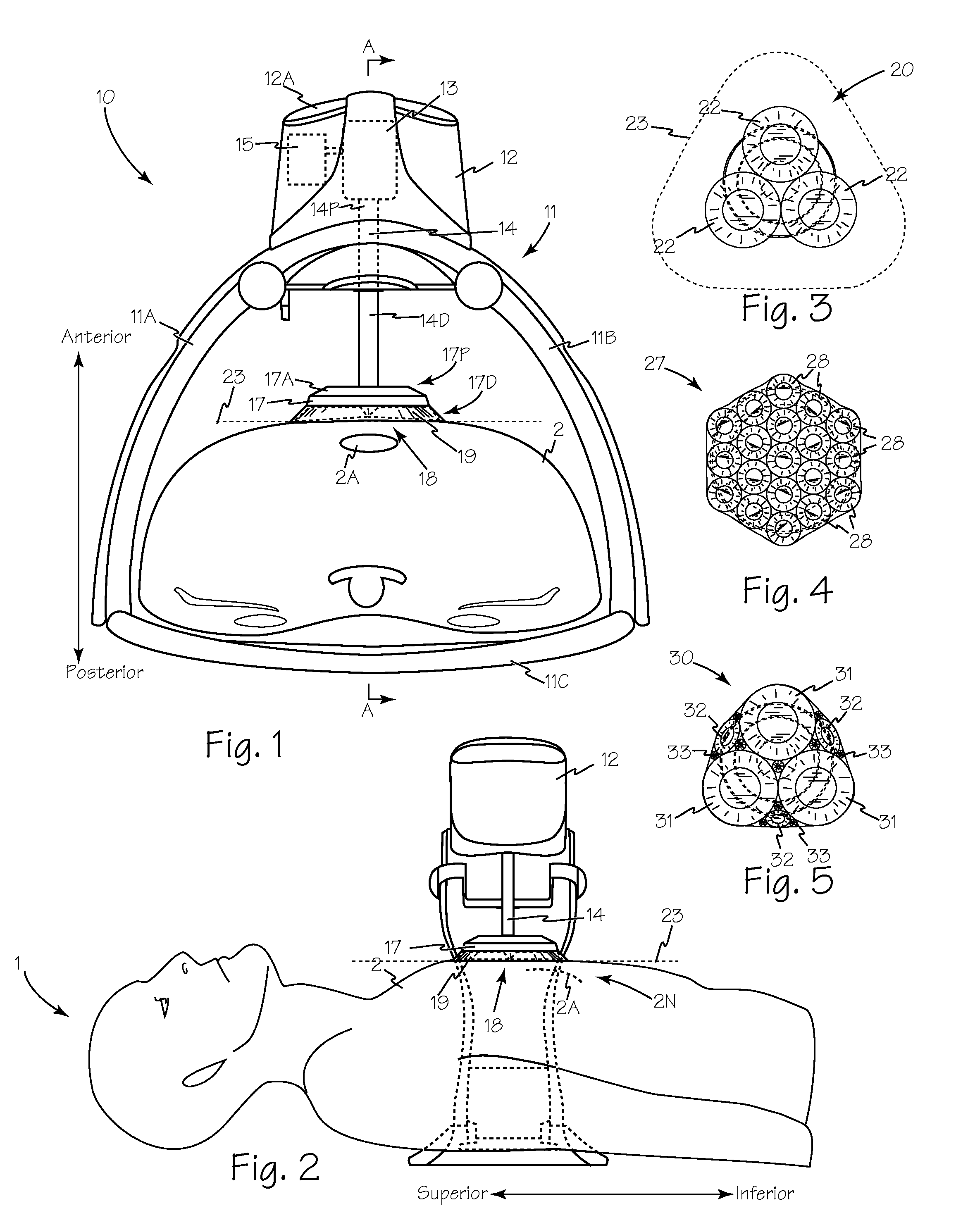 Method and Device for Performing Alternating Chest Compression and Decompression