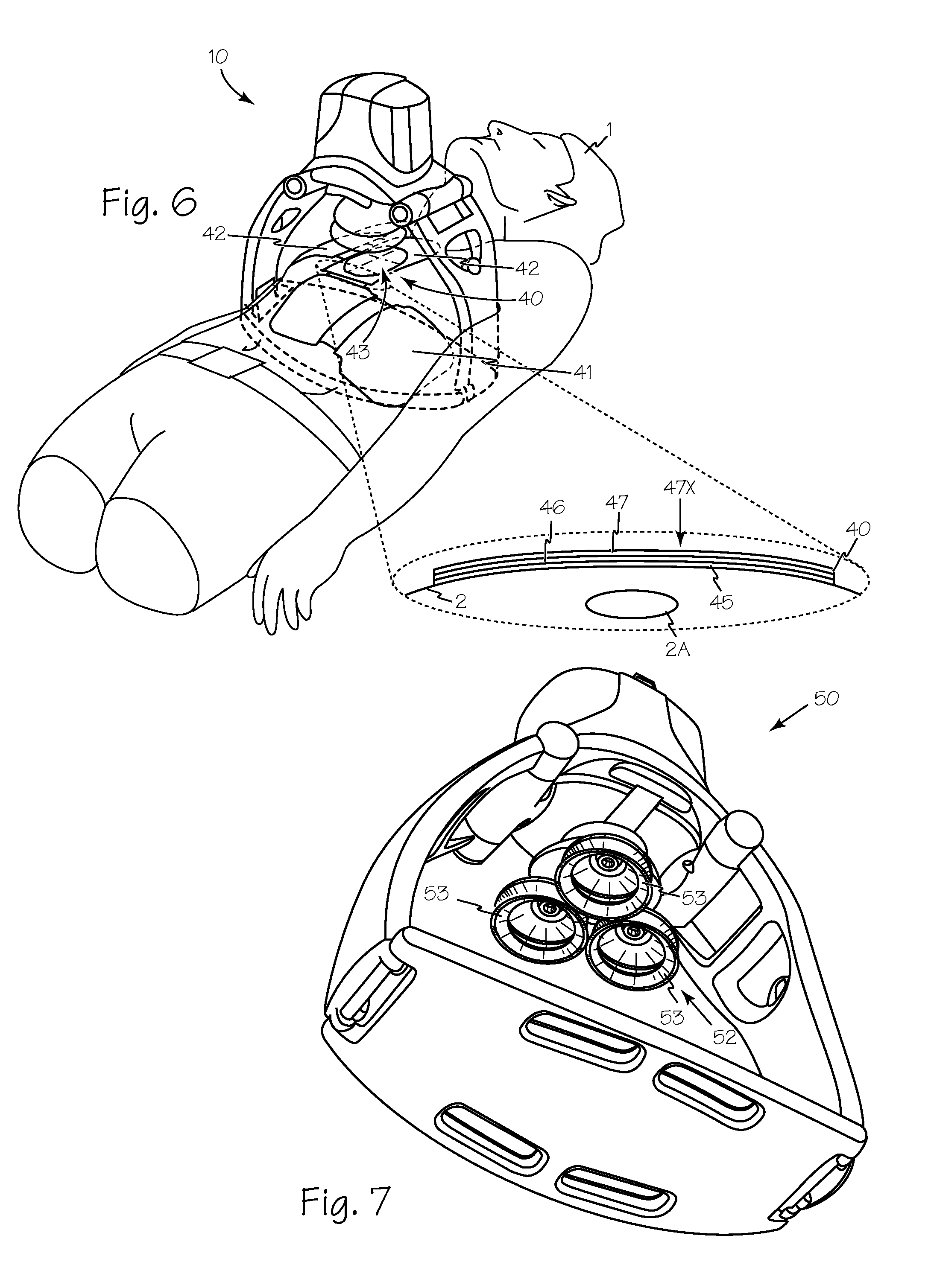 Method and Device for Performing Alternating Chest Compression and Decompression