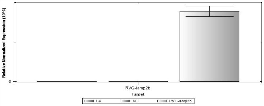 Application of miR-486-3p to preparation of product for treating neuroinflammation caused by SAH