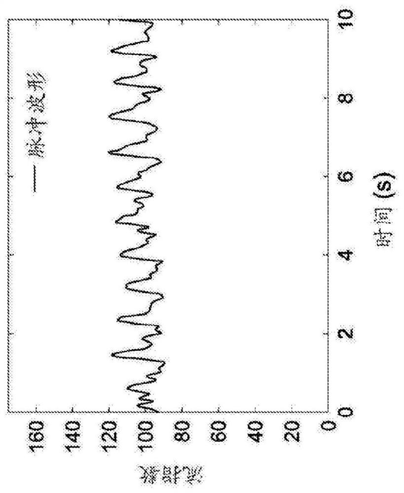 Blood flow measurement system using adherent laser speckle contrastive analysis