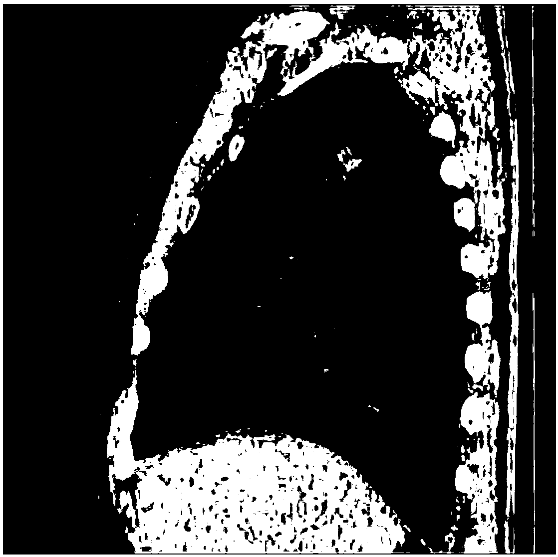 Quick image registration method based on B spline and Levenberg Marquardt optimization