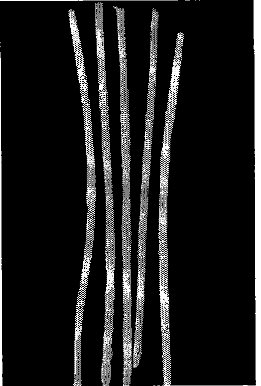 Ureteric branches support and preparation method thereof