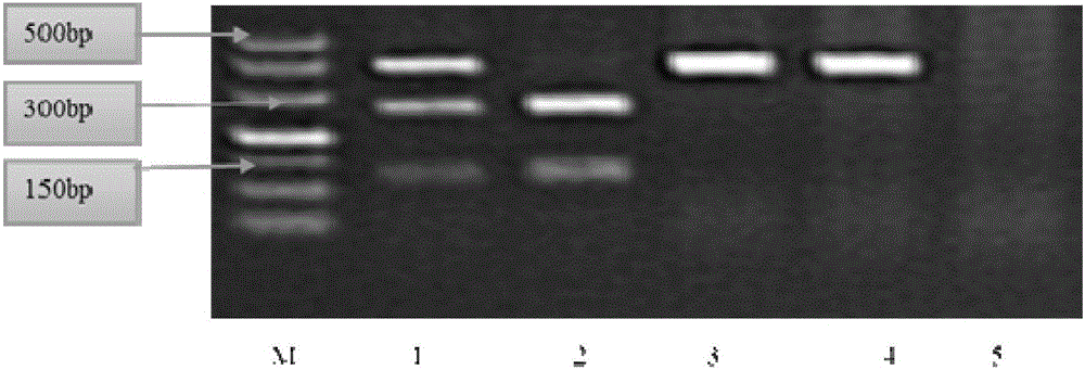 Application of RAG2 gene knockout rat in establishing personalized tumor treatment model