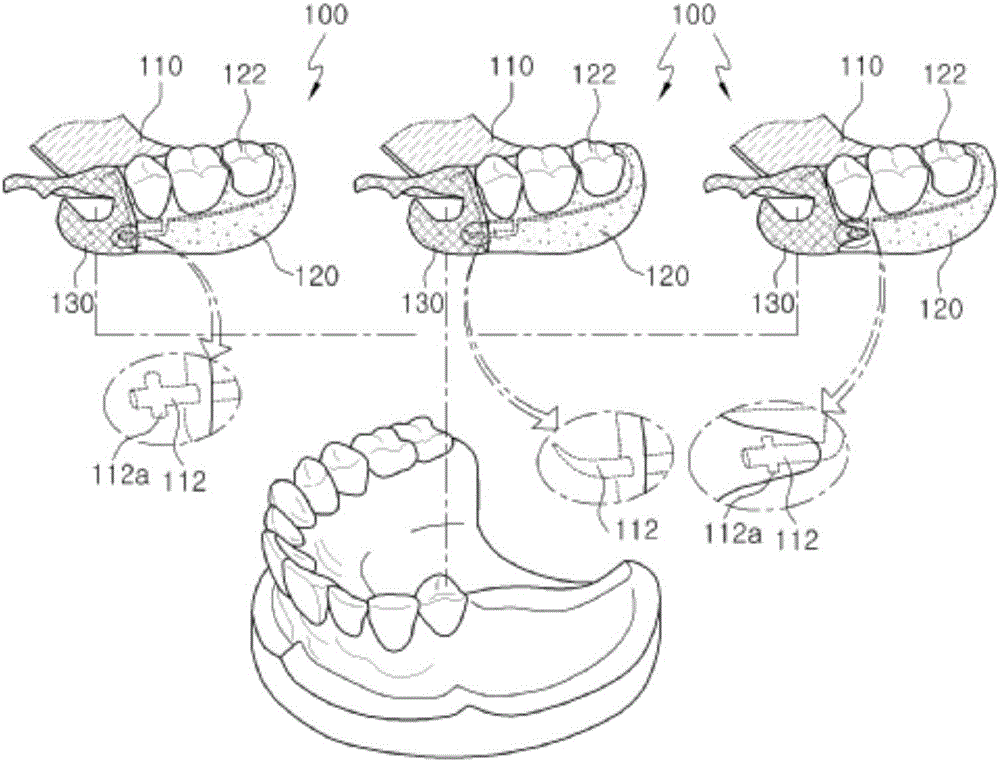 Partial denture and method for manufacturing same