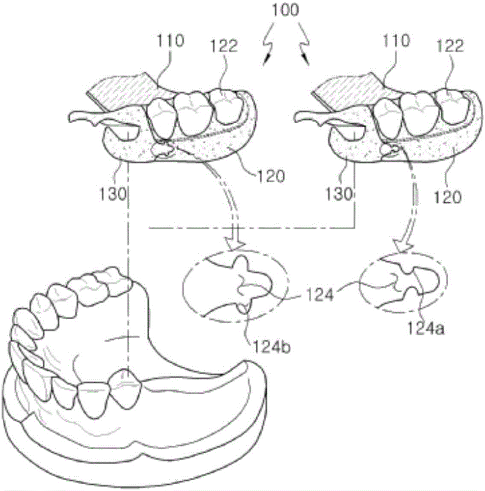 Partial denture and method for manufacturing same