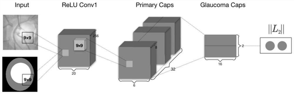 A glaucoma medical image classification method based on capsule theory