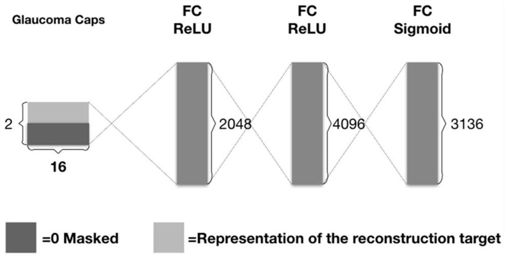 A glaucoma medical image classification method based on capsule theory