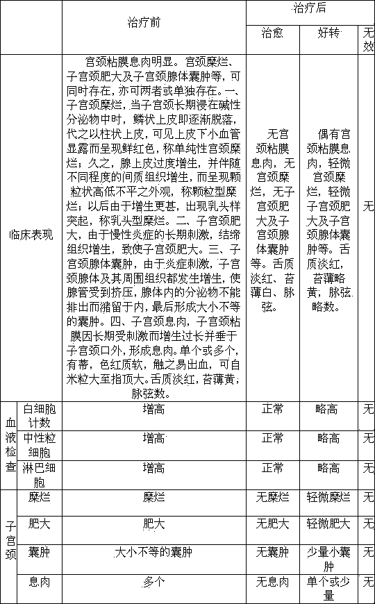 Preparation method of Chinese medicine irrigation solution for treating cervical mucosal polyp type chronic cervicitis