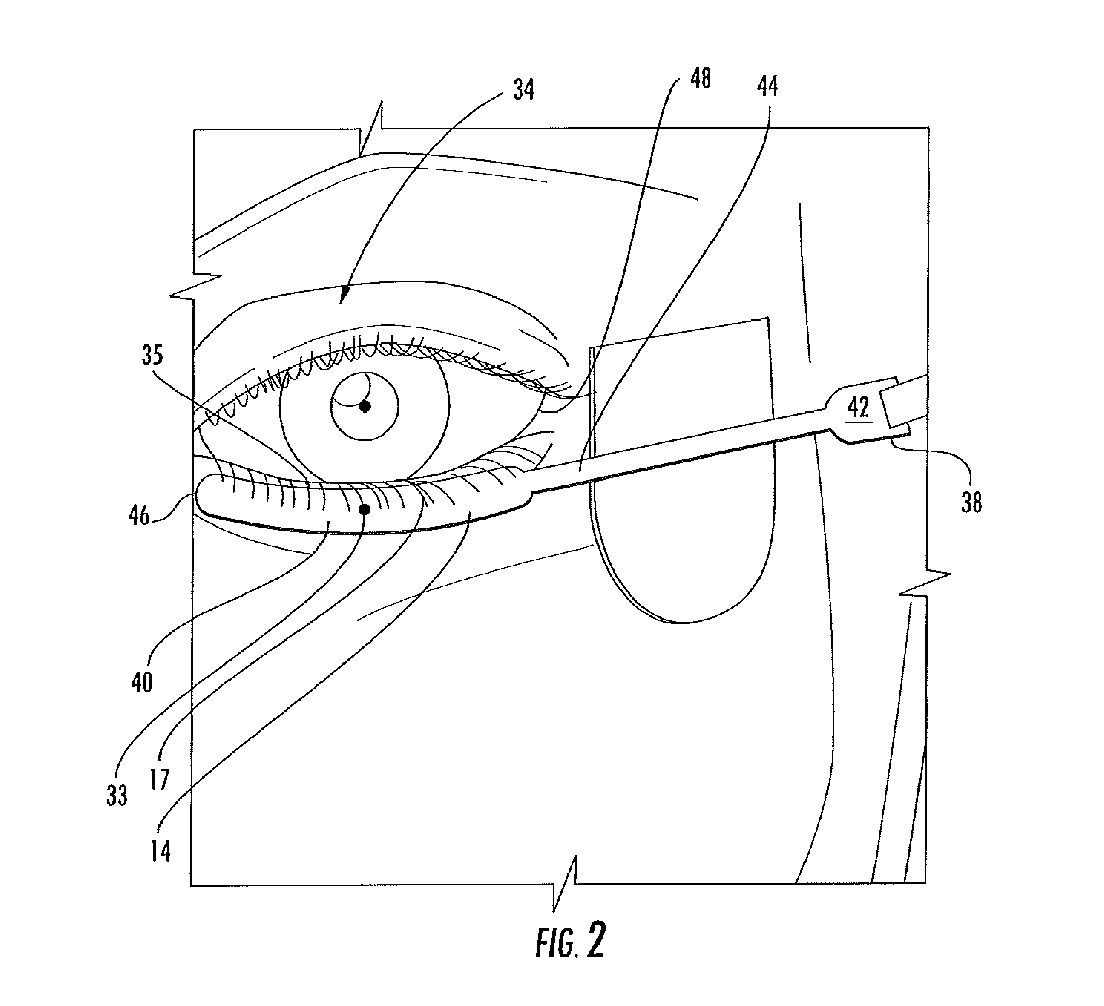 Electrode sensor assembly for electroretinography and pattern electroretinography