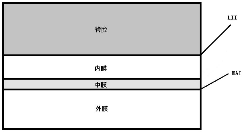 Carotid artery ultrasound image blood vessel and intima positioning method based on deep learning network