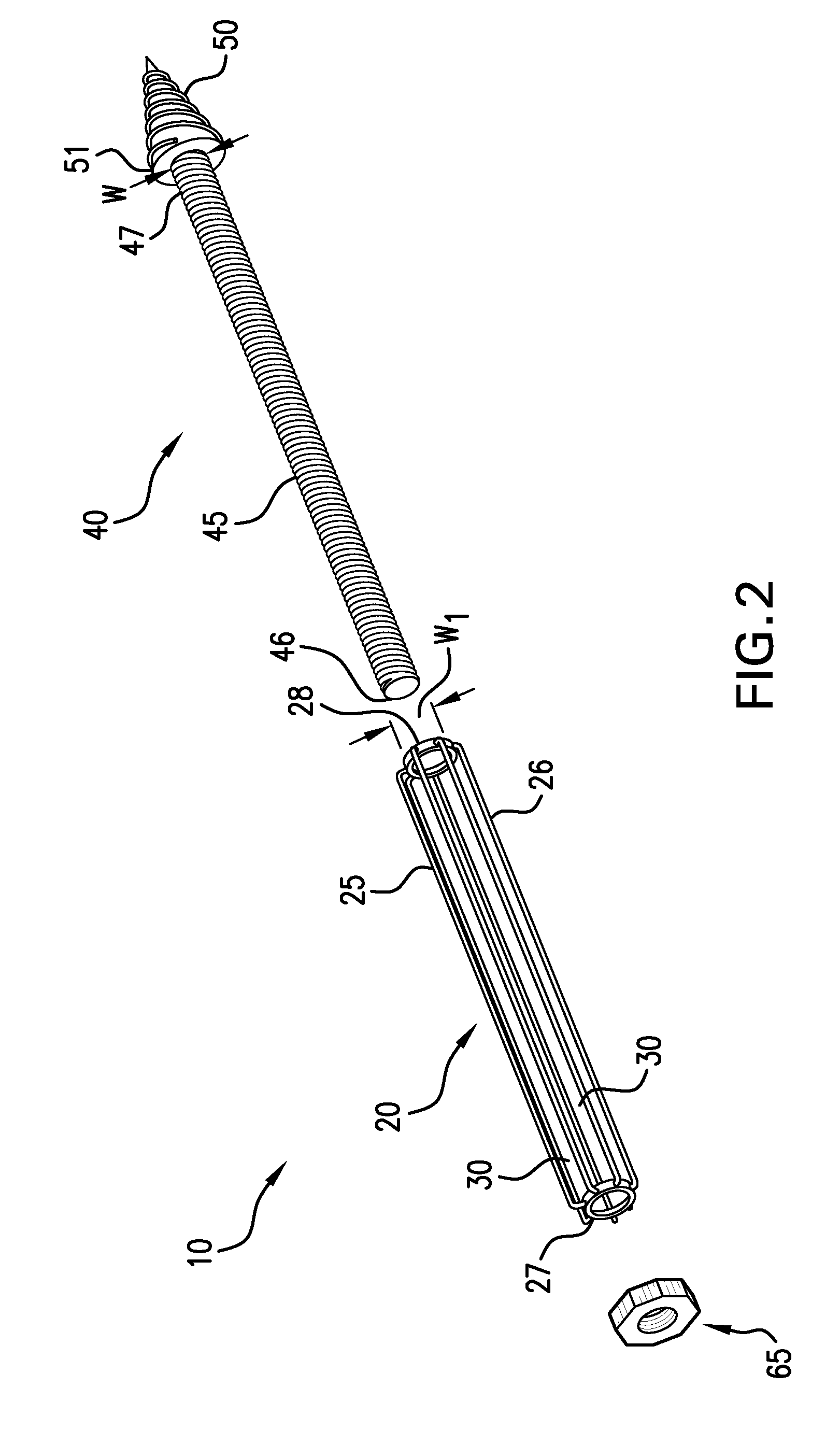 Methods of stabilizing the sacroiliac joint