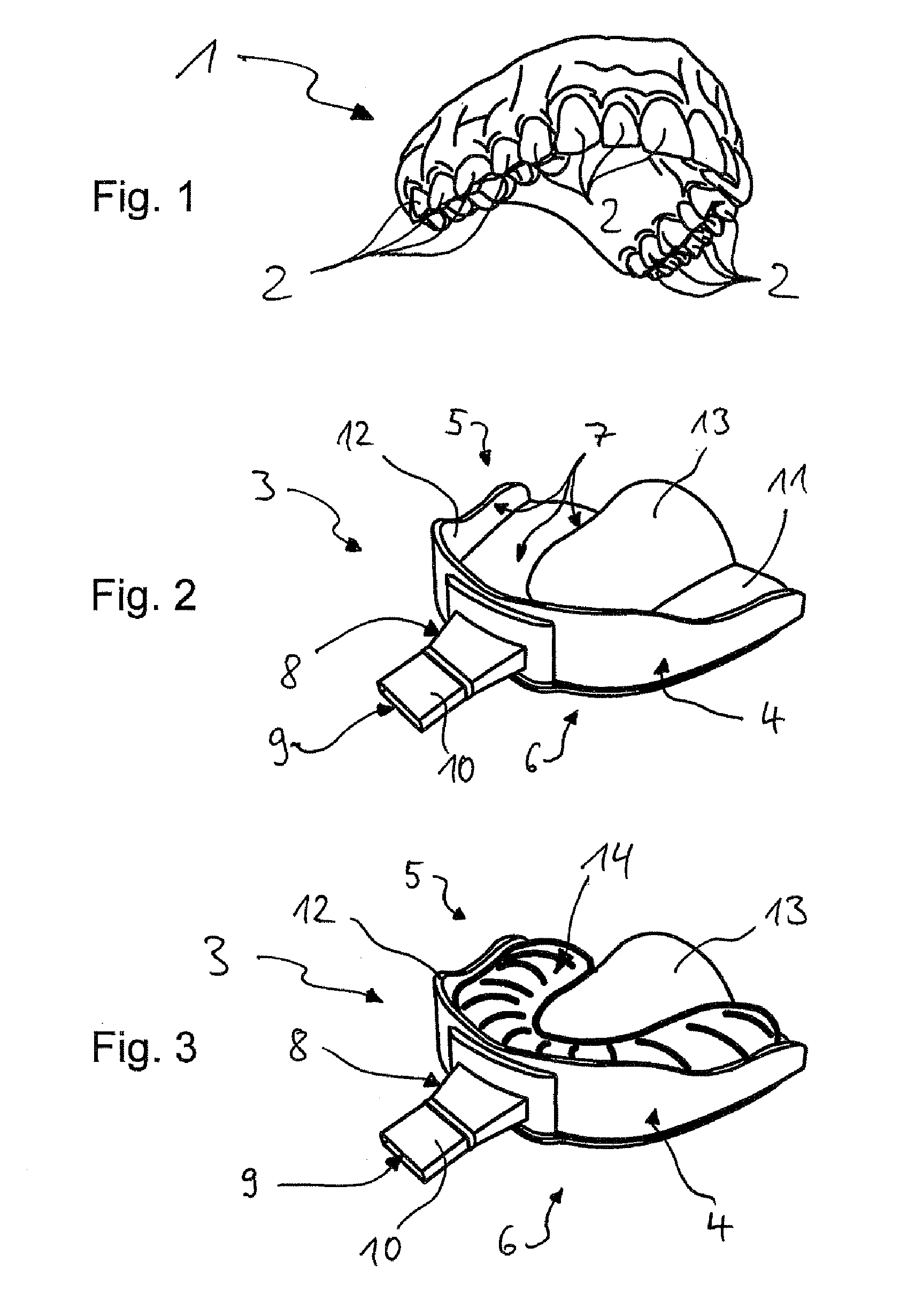 Impression tray, and method for capturing structures, arrangements or shapes, in particular in the mouth or human body