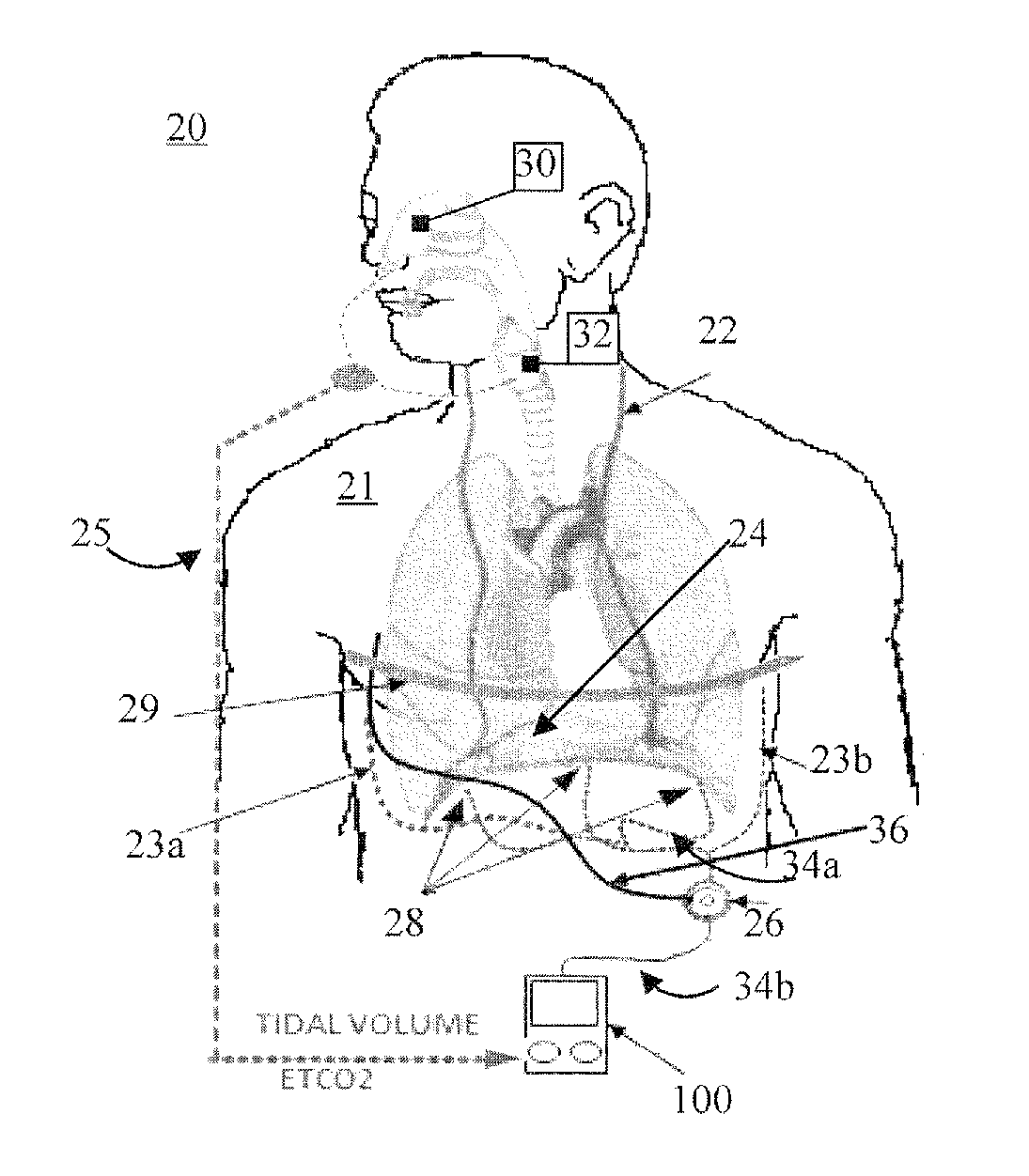 System and method for neuromorphic controlled adaptive pacing of respiratory muscles and nerves