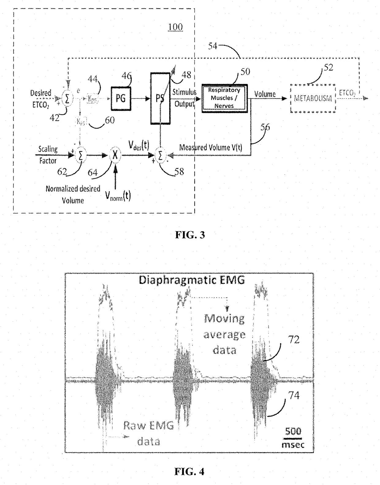 System and method for neuromorphic controlled adaptive pacing of respiratory muscles and nerves