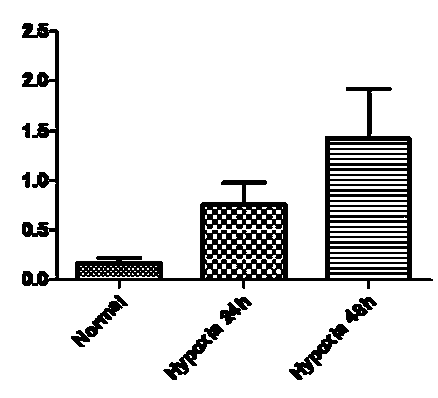 Application of immortalized human lung microvascular endothelial cell complex cell factor in preparing biological agent for repairing ischemic tissue injury